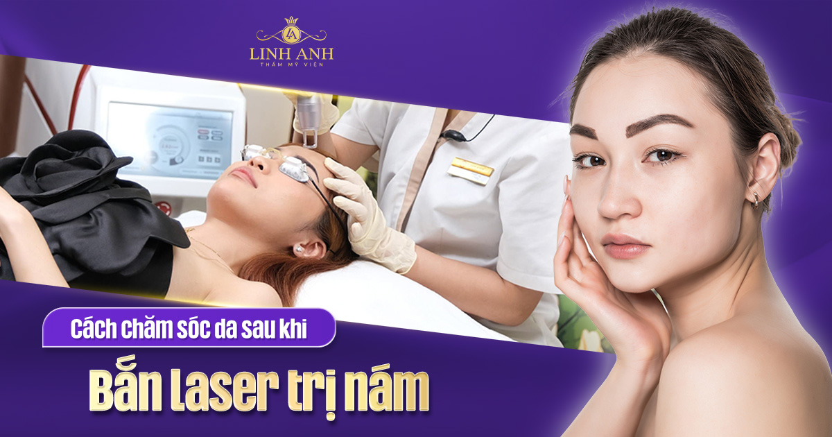 Cách chăm sóc da sau khi bắn laser trị nám khoa học, da nhanh lành