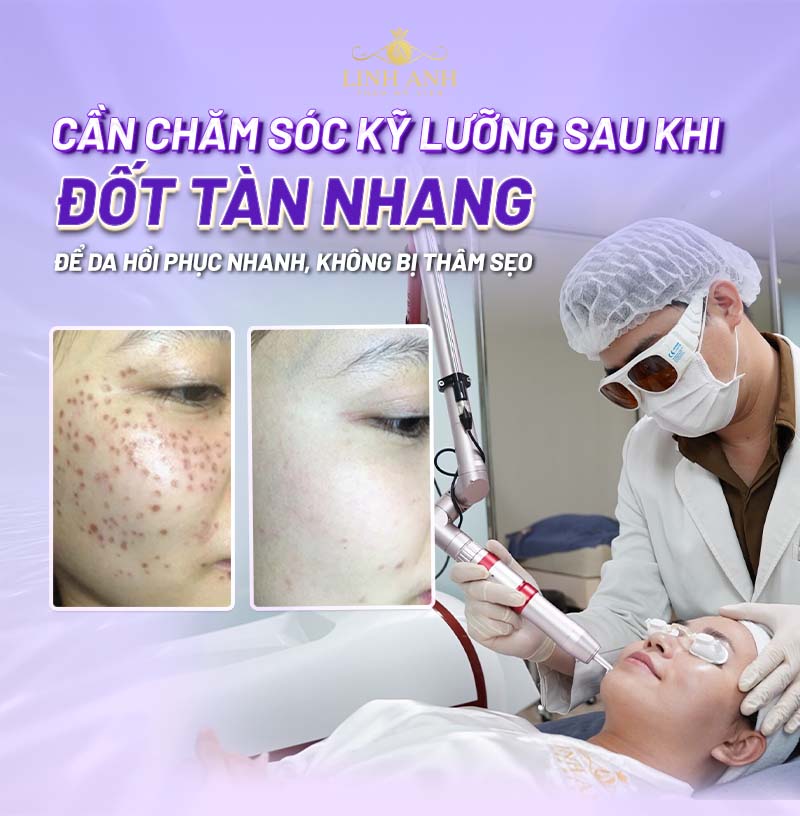 chăm sóc da sau bắn laser tàn nhang