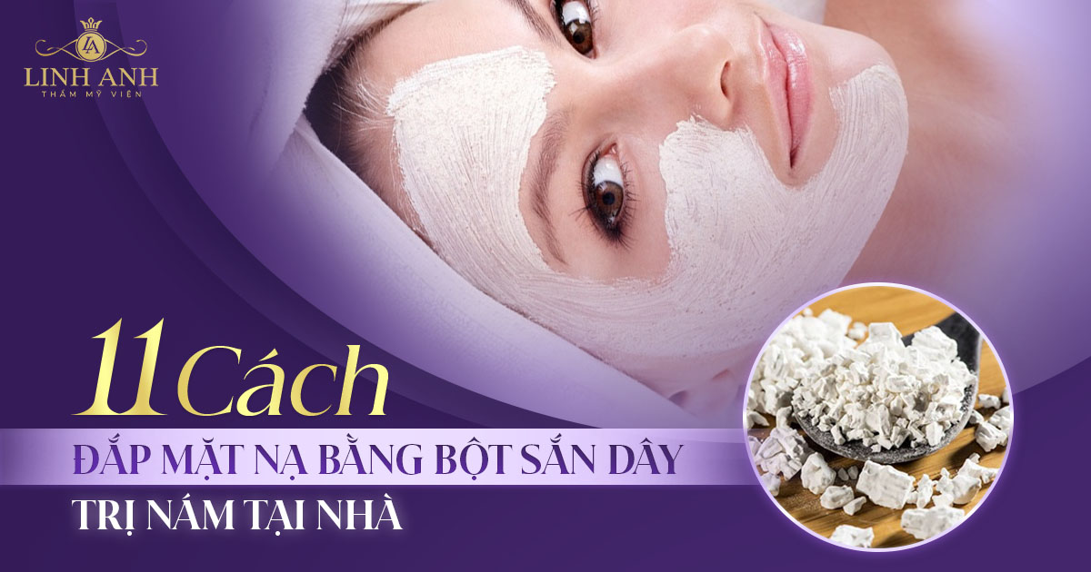 11 cách đắp mặt nạ bằng bột sắn dây trị nám dễ làm tại nhà