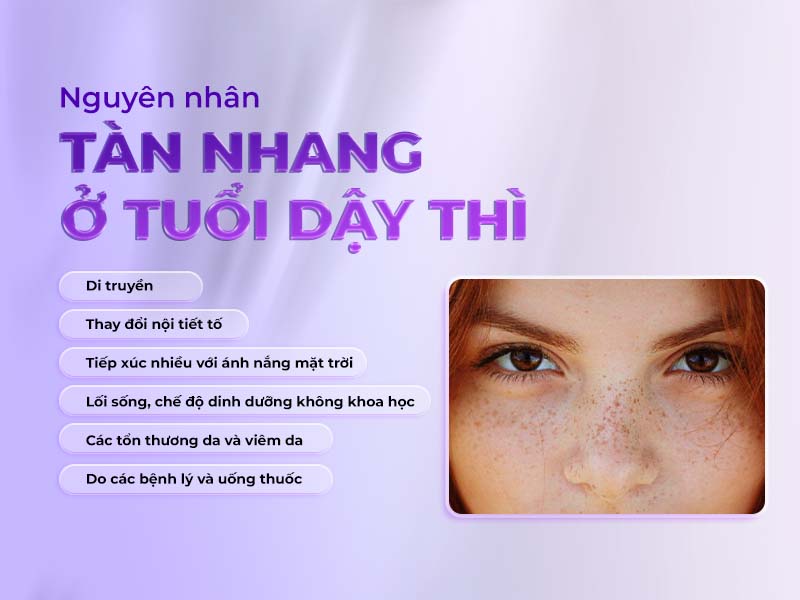 nguyên nhân tàn nhang ở tuổi dậy thì