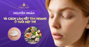 cách làm hết tàn nhang tuổi dậy thì