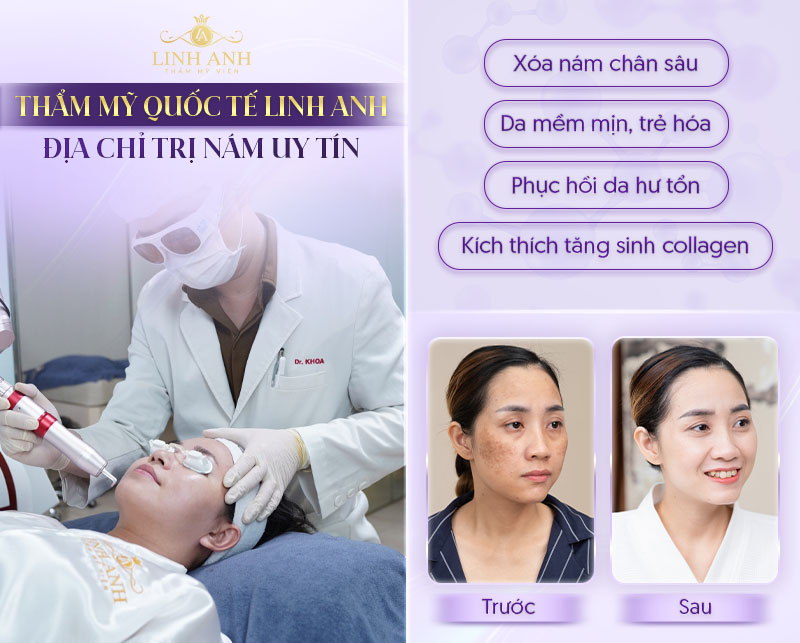 công nghệ điều trị chuyên sâu
