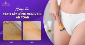 Cách tẩy lông vùng kín