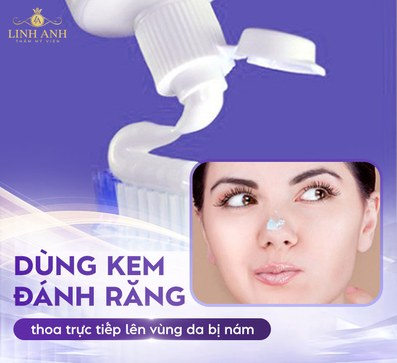 cải thiện nám bằng kem đánh răng