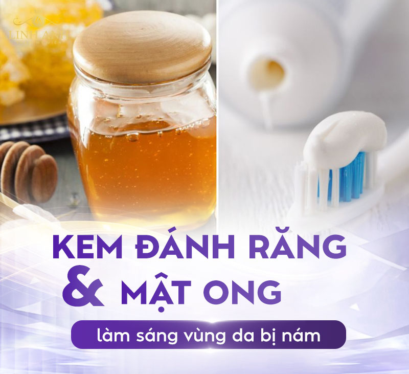 mật ong kết hợp kem đánh răng trị nám