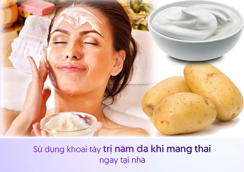 Dùng khoai tây trị nám khi mang thai