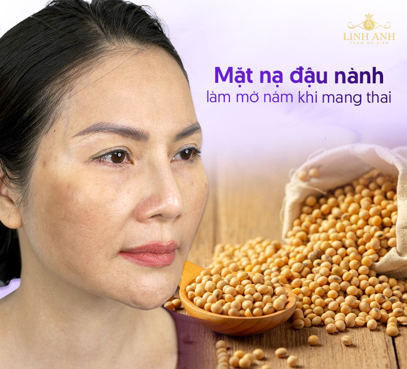 Dùng đậu nành trị nám da khi mang thai