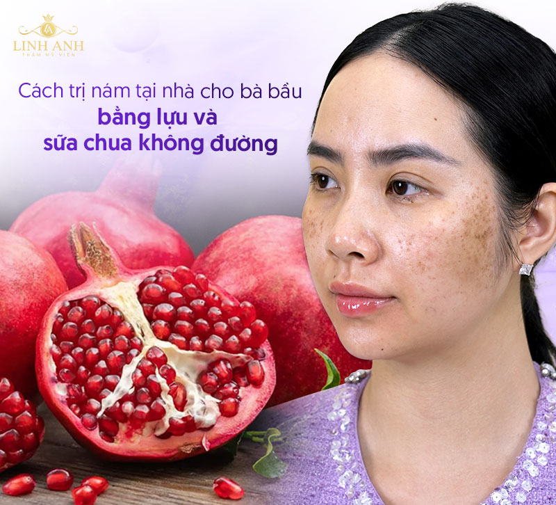 Cách trị nám da dành cho bà bầu dân gian với lựu