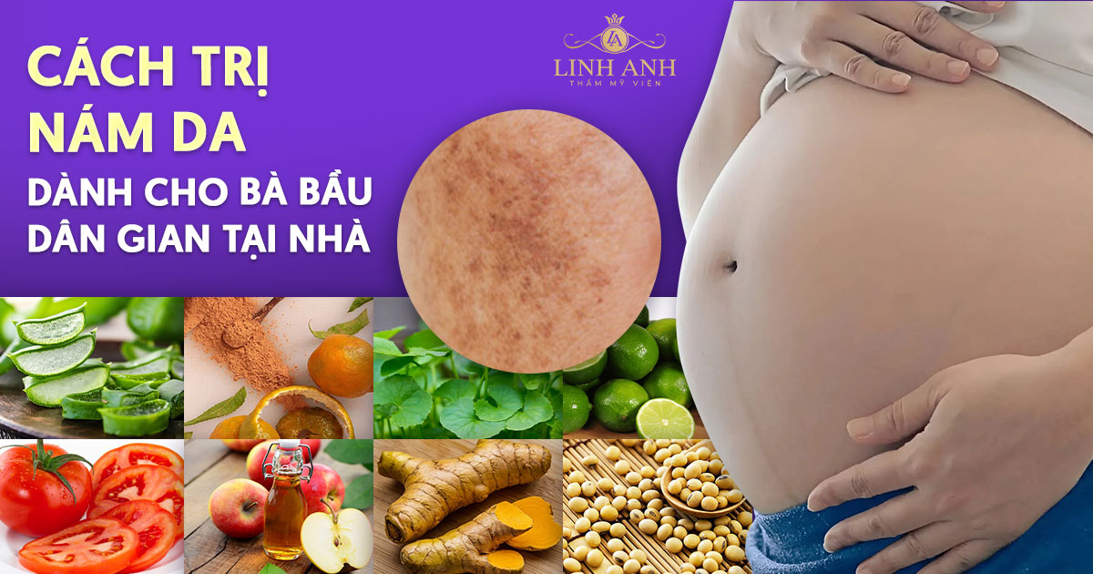 13 cách trị nám da dành cho bà bầu dân gian tại nhà