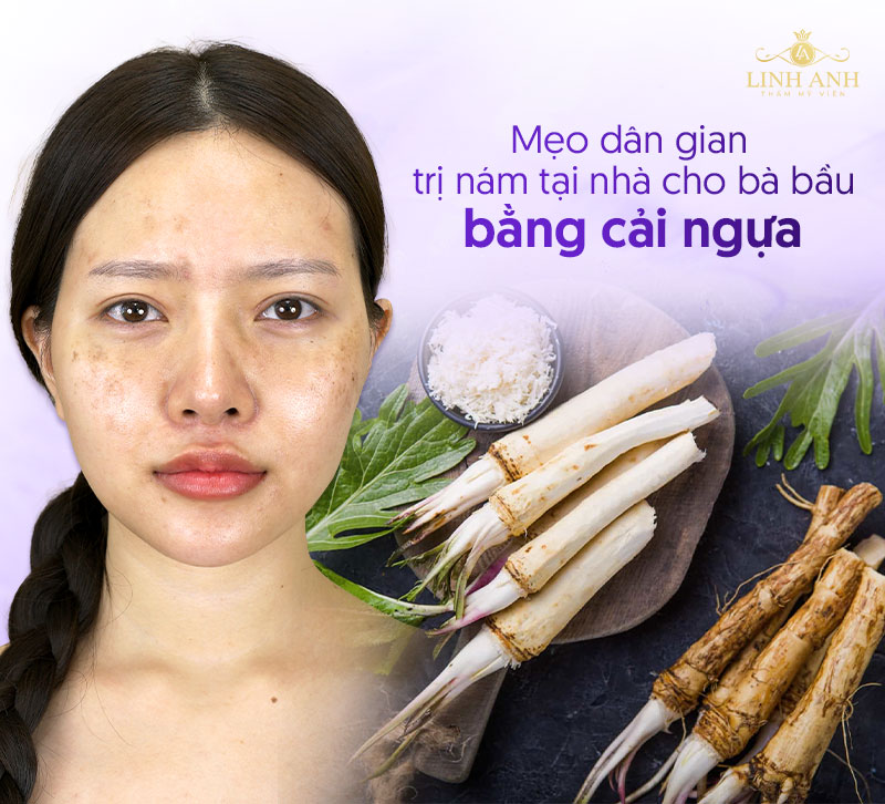 Dùng cây cải ngựa trị nám da khi mang thai