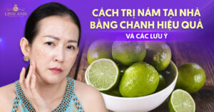 Cách trị nám da tại nhà bằng chanh