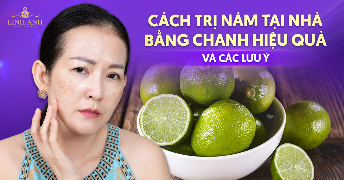 7 cách trị nám tại nhà bằng chanh hiệu quả và các lưu ý