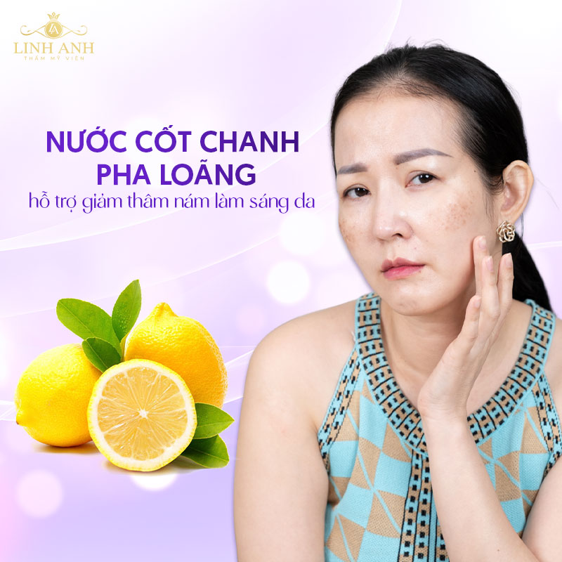 Cách trị nám tại nhà bằng chanh pha loãng