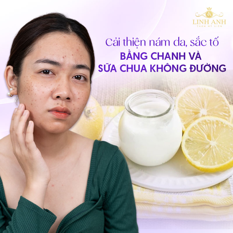 Trị nám bằng chanh và sữa chua