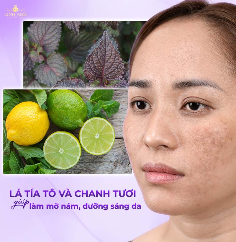 trị nám tại nhà bằng chanh tươi