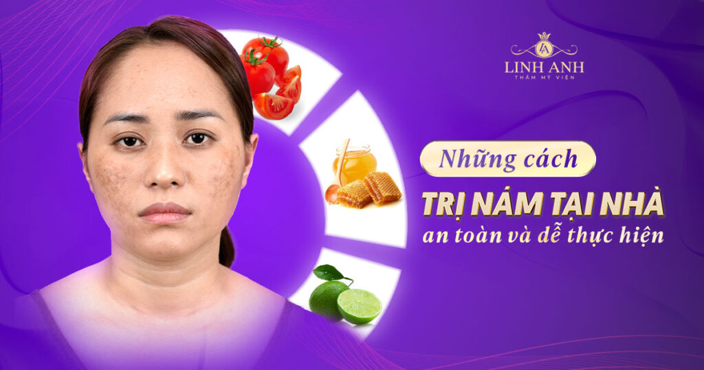 cách trị nám tại nhà