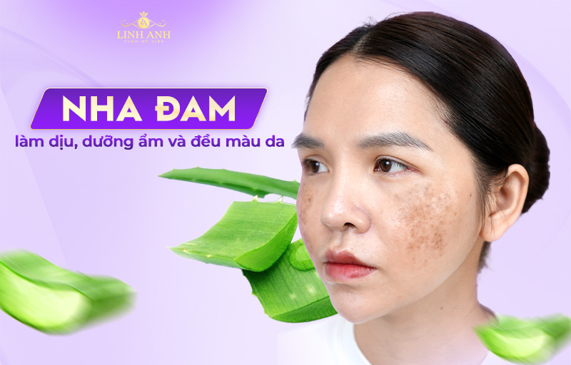 dùng nha đam dưỡng da trị nám