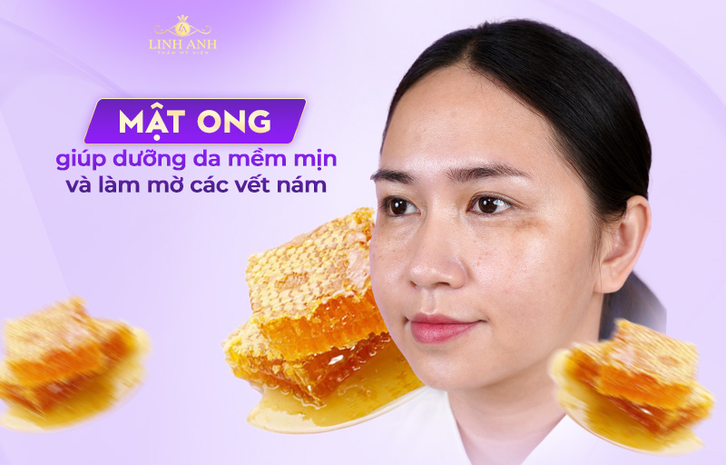 sử dụng mật ong trị nám