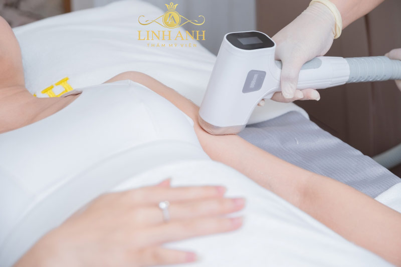 Cách ức chế mọc lông