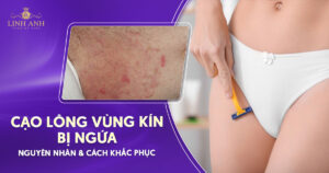 Cạo lông vùng kín bị ngứa