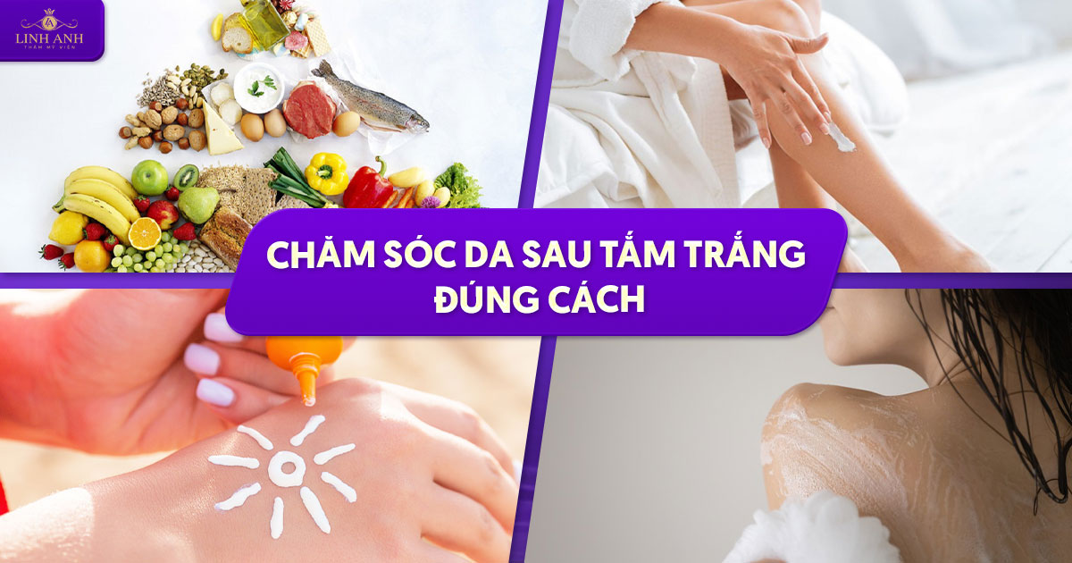 Chăm sóc da sau tắm trắng – Mẹo dưỡng da trắng hồng, khỏe mạnh