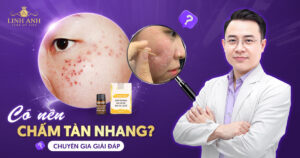 chấm tàn nhang