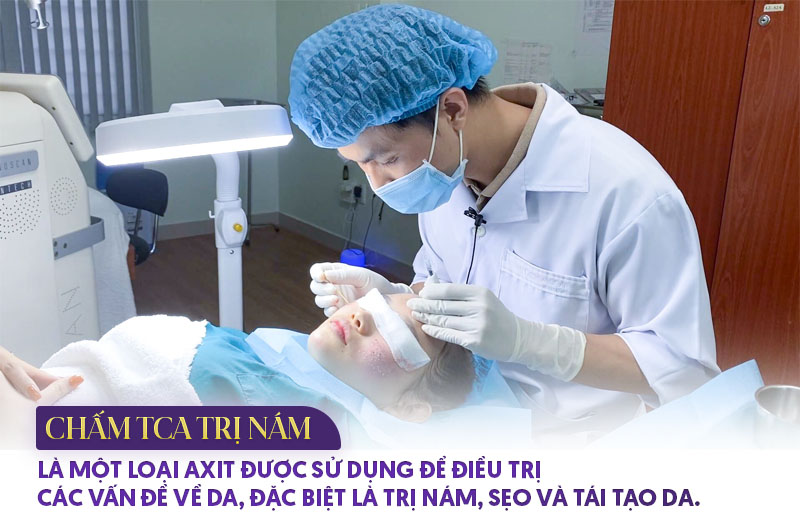 tca là gì