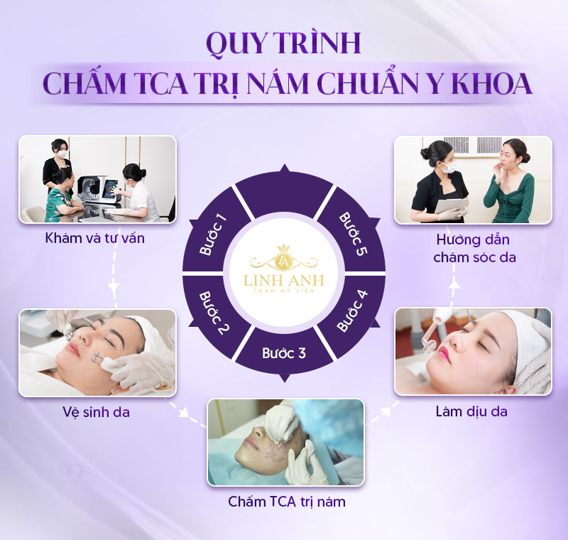 quy trình chấm cta trị nám