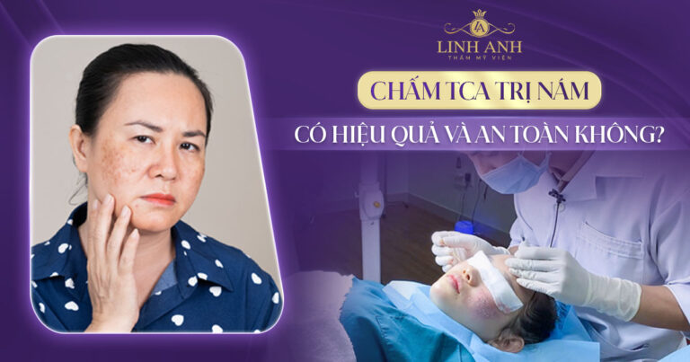 Chấm TCA trị nám như thế nào? Có hiệu quả và an toàn không?