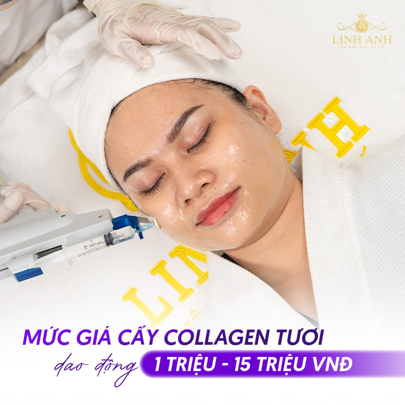 chi phí Cấy Collagen tươi tại Linh Anh