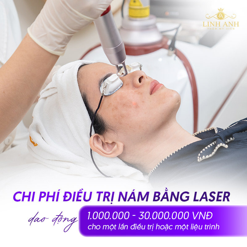chi phí Trị nám bằng laser tại Linh Anh