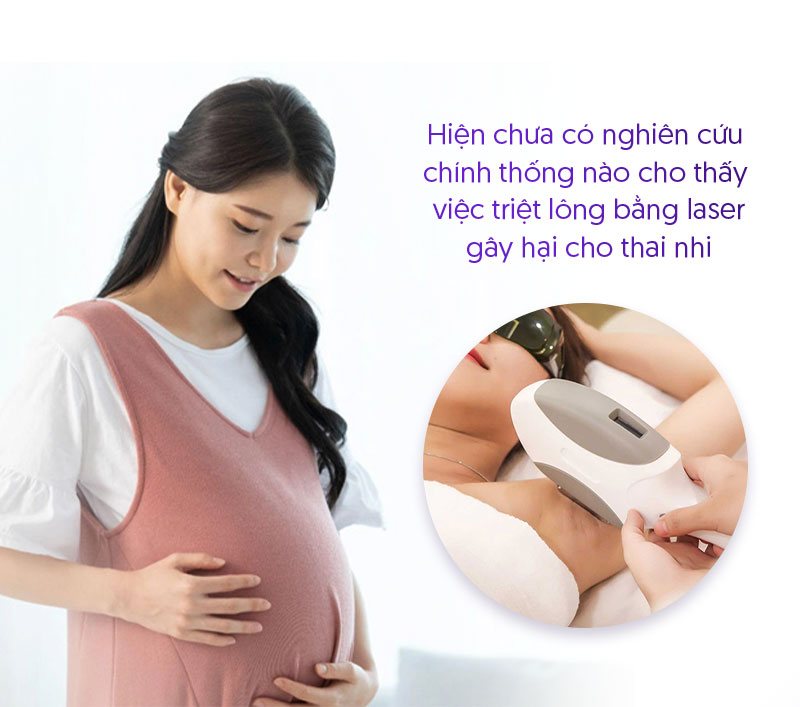Có bầu triệt lông nách bằng laser được không Có bầu triệt lông nách bằng laser được không