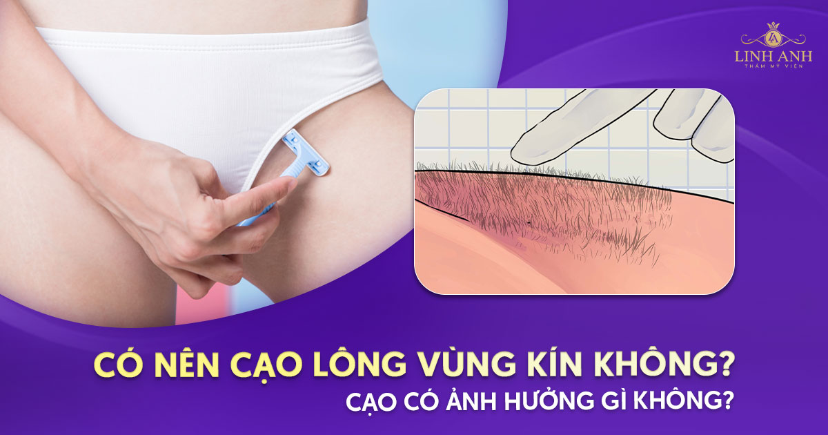 có nên cạo lông vùng kín