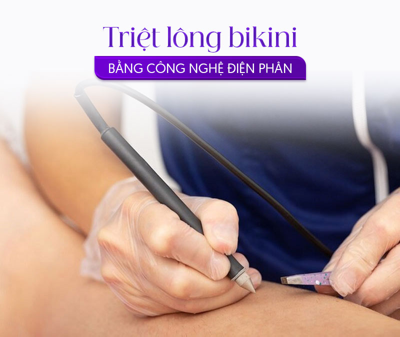 có nên triệt lông bikini không có nên triệt lông bikini không