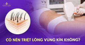 có nên triệt lông vùng kín