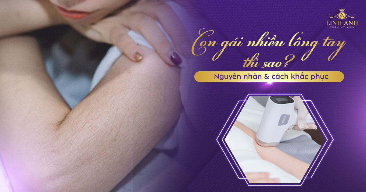 Con gái nhiều lông tay thì sao? Cách khắc phục tình trạng lông tay mọc nhiều