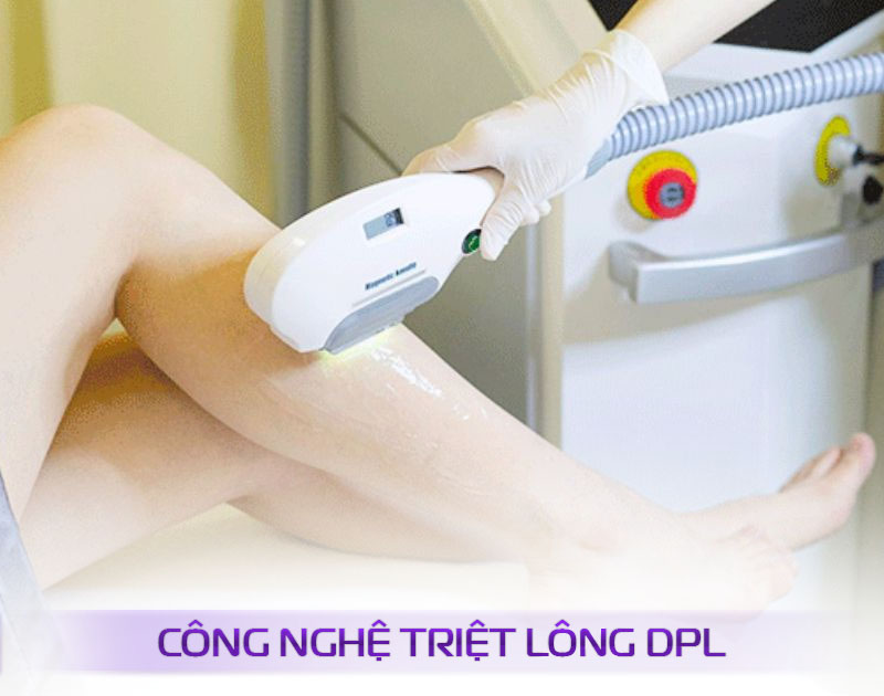 công nghệ triệt lông tốt nhất công nghệ triệt lông tốt nhất