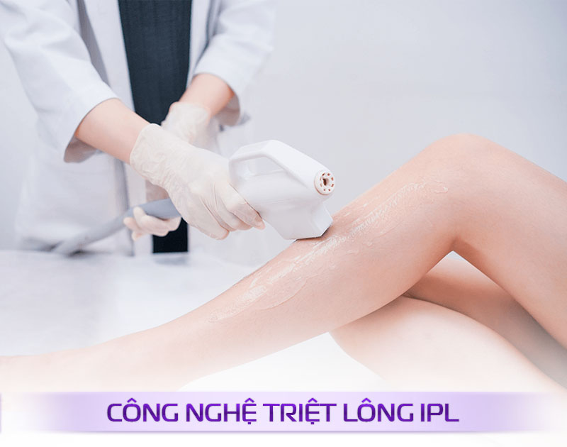công nghệ triệt long công nghệ triệt long