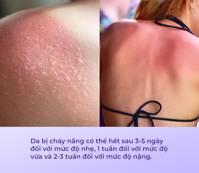 da phục hồi trong bao lâu