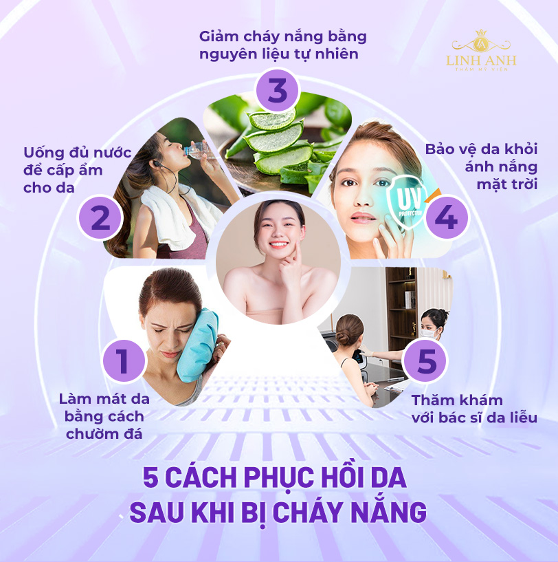 phục hồi da bị cháy nắng