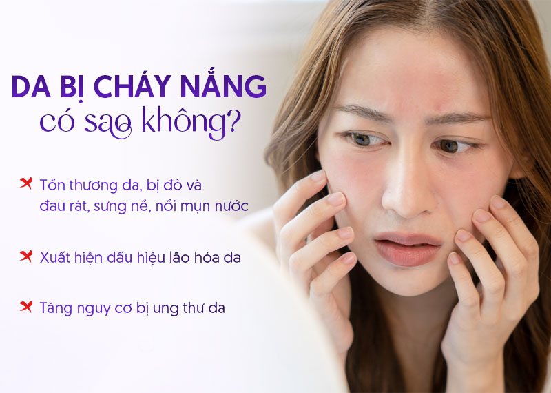 Da bị cháy nắng có sao không