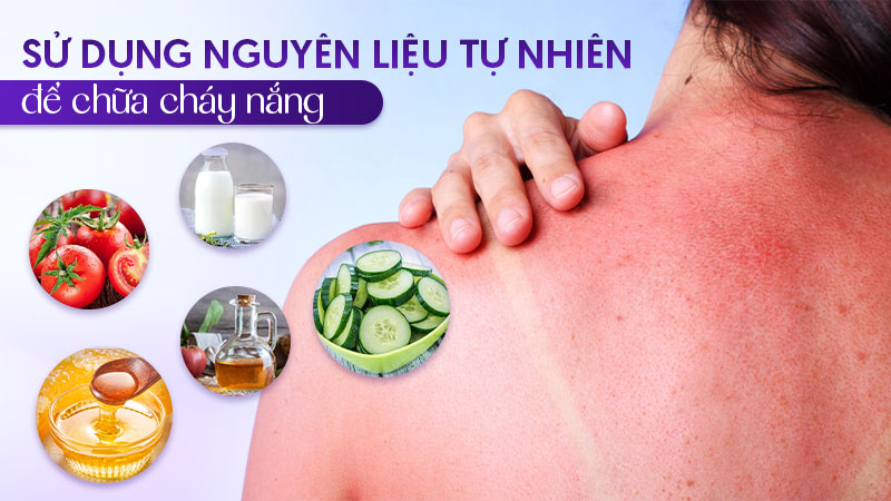 Dùng nguyên liệu tự nhiên chữa da nám nắng