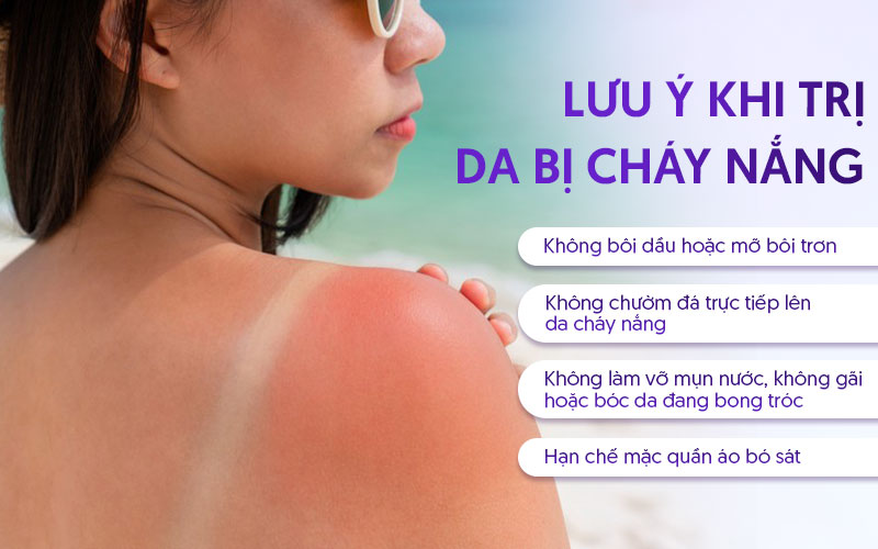 Lưu ý khi chữa da bị cháy nắng sạm đen