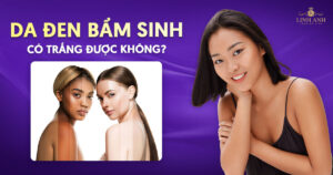 Da đen bẩm sinh có trắng được không