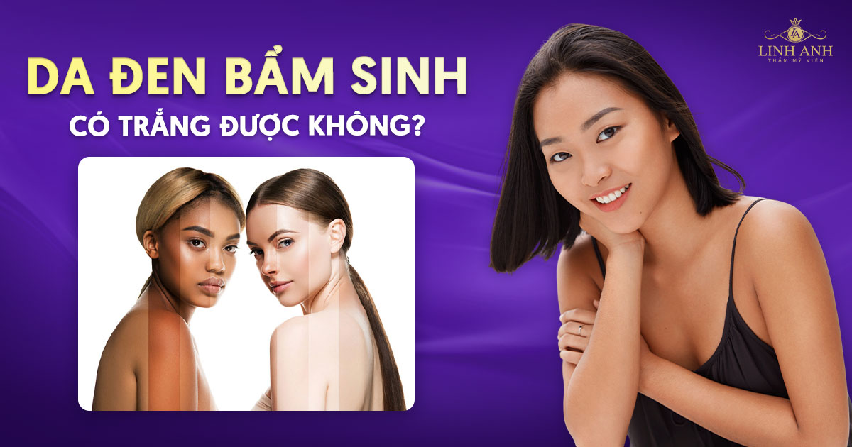 Da đen bẩm sinh có trắng được không? Cách dưỡng trắng da hiệu quả
