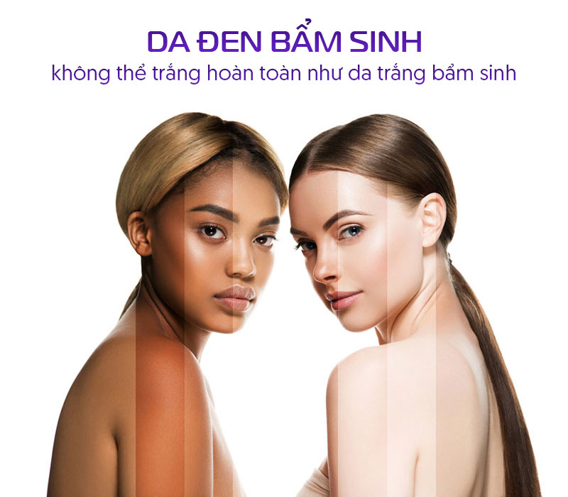 Da đen bẩm sinh có trắng lên được không