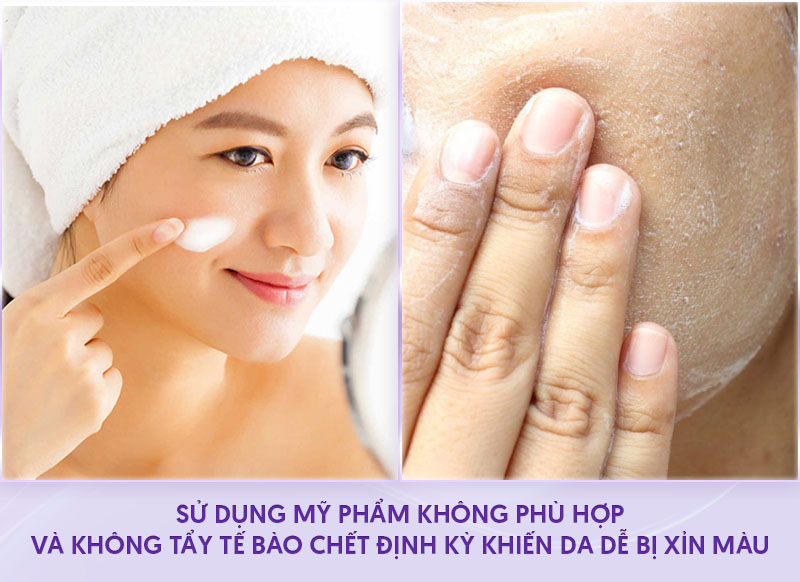 Da mặt đen hơn da tay chân Da mặt đen hơn da tay chân