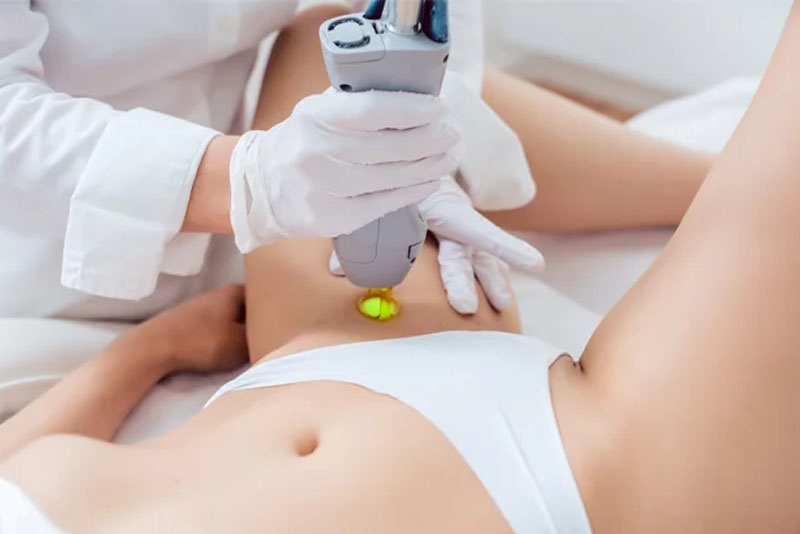 dáng lông vùng kín đẹp dáng lông vùng kín đẹp