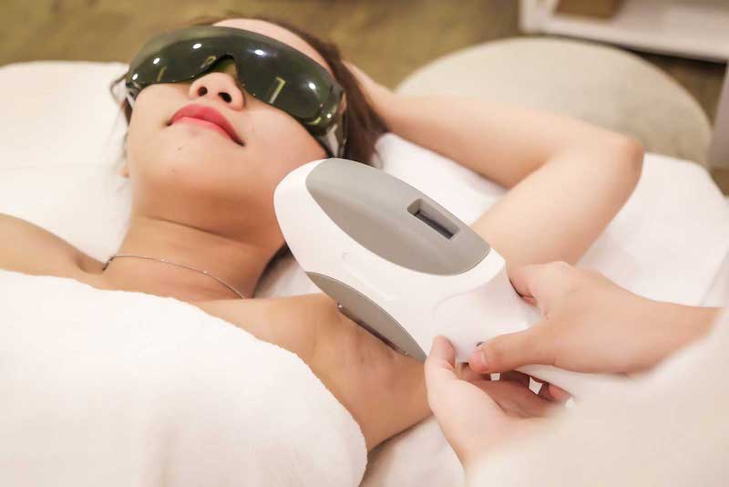 Điều trị lông mọc ngược bằng công nghệ laser Điều trị lông mọc ngược bằng công nghệ laser