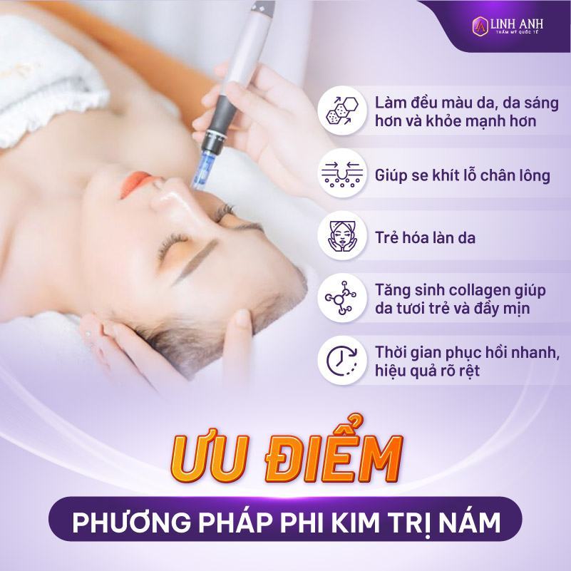 phi kim điều trị nám - Viện thẩm mỹ Quốc tế Linh Anh Thẩm mỹ viện Linh Anh